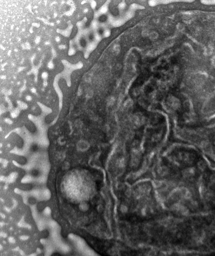 Electron microscopy image of a bacterium